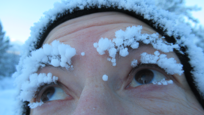 Hoar frost on my face